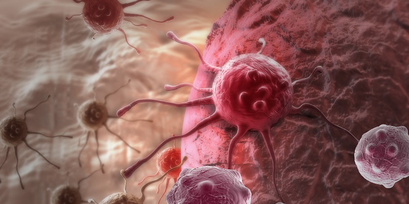 Inmuno-Oncología, nueva terapia contra el cáncer avanzado
