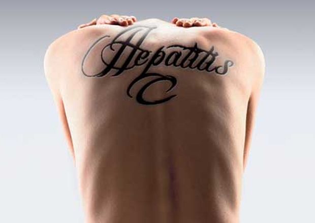 Tatuajes cosméticos, elevado riesgo de hepatitis C