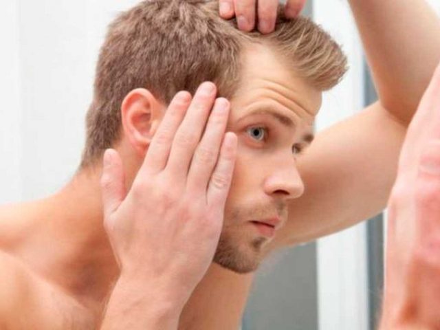 La mitad de hombres jóvenes pierden cabello por estrés y hormonas
