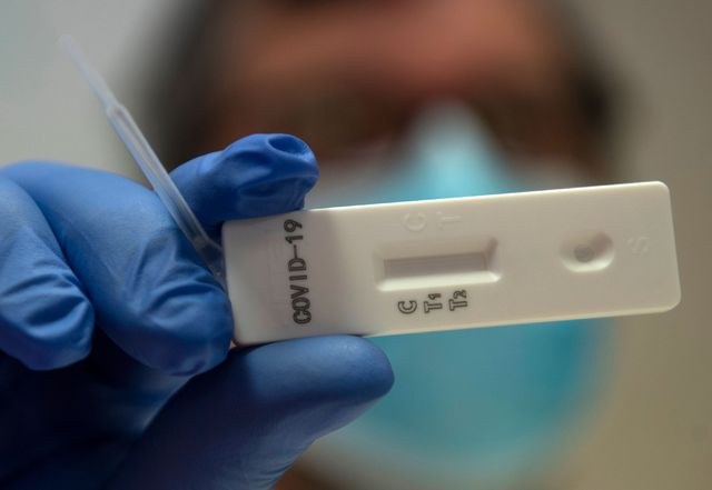 Se propagó Coronavirus rápidamente a fines de 2019: UCL